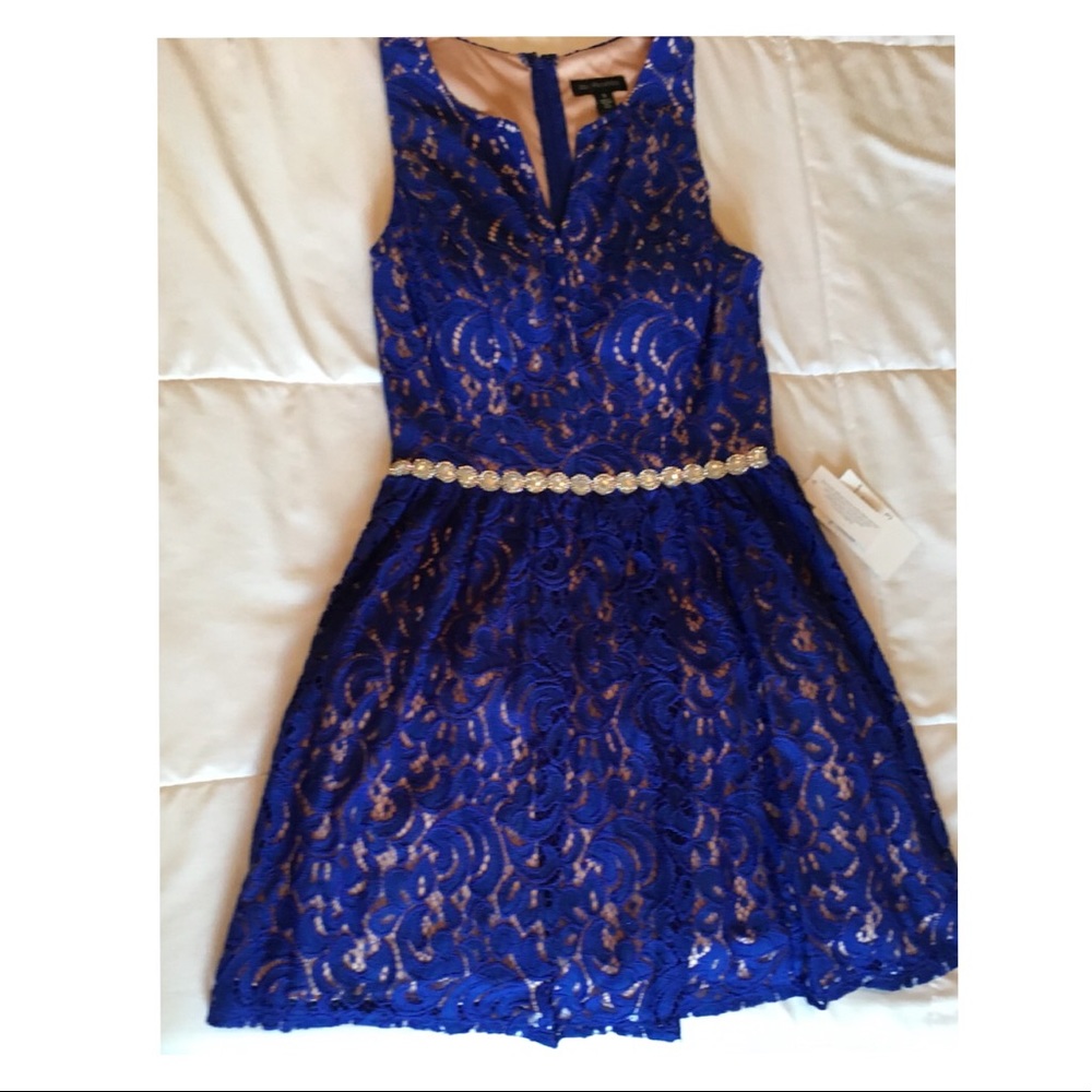 Short Blue Lace Dress